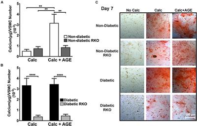 RAGE Differentially Altered in vitro Responses in Vascular Smooth Muscle Cells and Adventitial Fibroblasts in Diabetes-Induced Vascular Calcification